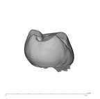 UW101-285 Homo naledi LRM1 distal
