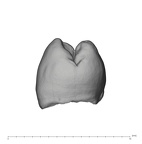 UW101-298 Homo naledi LRP3 mesial