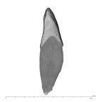 UW101-335 Homo naledi LRI2 distal