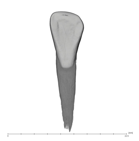UW101-335 Homo naledi LRI2 lingual