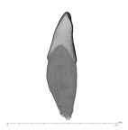 UW101-335 Homo naledi LRI2 mesial