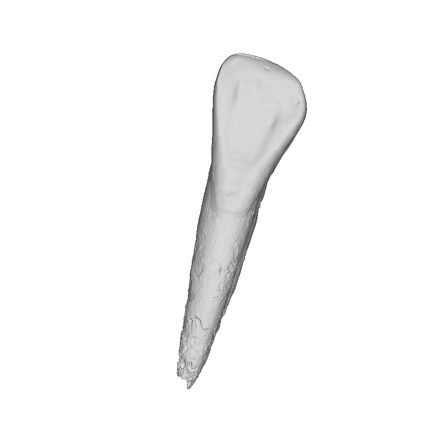 UW101-335 Homo naledi LRI2 ply