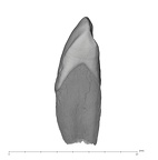 UW101-339 Homo naledi LRC mesial
