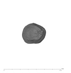 UW101-359 Homo naledi LLC apical