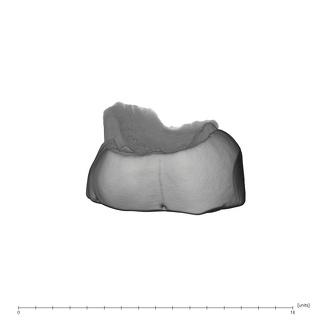 UW101-384 Homo naledi URDM2 lingual