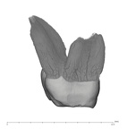 UW101-445 Homo naledi ULM1 mesial