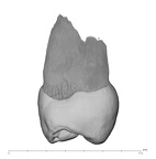 UW101-455 Homo naledi UP mesial