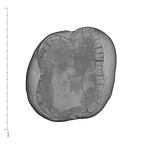 UW101-505 Homo naledi ULM2 apical