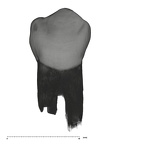 UW101-506 Homo naledi LRP3 buccal