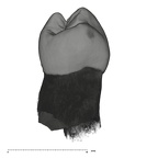 UW101-506 Homo naledi LRP3 distal