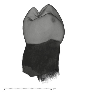 UW101-506 Homo naledi LRP3 distal