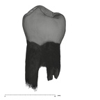 UW101-506 Homo naledi LRP3 lingual