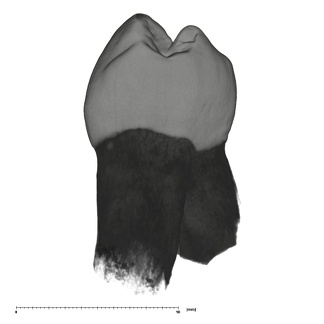 UW101-506 Homo naledi LRP3 mesial