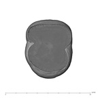 UW101-507 Homo naledi LRM2 apical