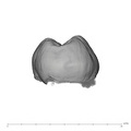 UW101-507 Homo naledi LRM2 distal