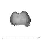 UW101-507 Homo naledi LRM2 distal