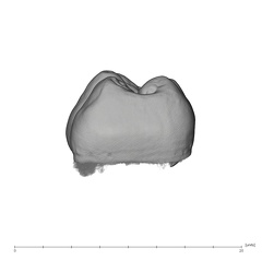 UW101-507 Homo naledi LRM2 mesial