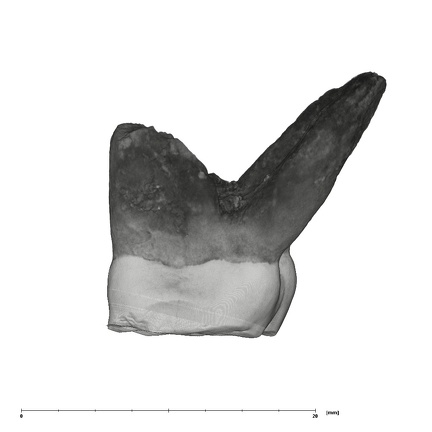 UW101-525+1574 Homo naledi URM1 mesial