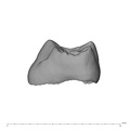 UW101-544a Homo naledi URDM2 mesial