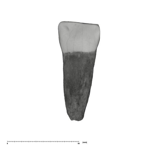 UW101-544c Homo naledi URDI1 lingual