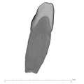 UW101-591 Homo naledi ULI1 distal