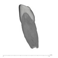 UW101-591 Homo naledi ULI1 mesial