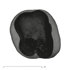 UW101-593 Homo naledi URM2 apical