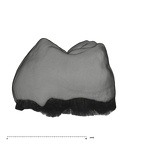UW101-593 Homo naledi URM2 mesial