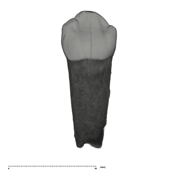 UW101-595 Homo naledi ULDC lingual