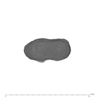 UW101-654 Homo naledi M root apical