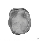 UW101-655 Homo naledi LRM apical