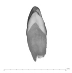 UW101-706 Homo naledi ULC mesial