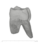 UW101-708 Homo naledi ULM1 mesial