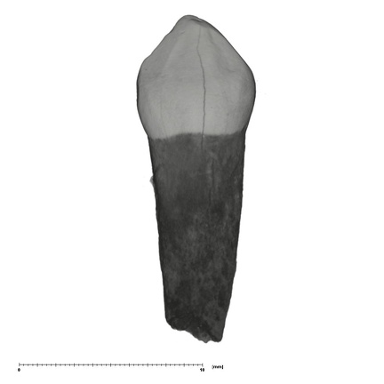 UW101-728 Homo naledi URDC lingual