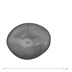 UW101-728 Homo naledi URDC occlusal