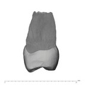 UW101-786 Homo naledi UP distal