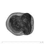 UW101-789 Homo naledi LLM2 apical