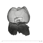 UW101-789 Homo naledi LLM2 mesial