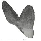 UW101-796 Homo naledi ULM1 distal