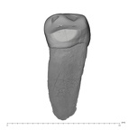 UW101-800 Homo naledi LRP3 distal