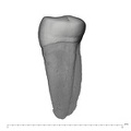 UW101-800 Homo naledi LRP3 mesial