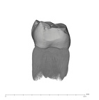UW101-809 Homo naledi LLM1 mesial