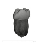 UW101-814 Homo naledi LLM1 distal