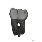 UW101-814 Homo naledi LLM1 lingual
