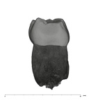 UW101-814 Homo naledi LLM1 mesial