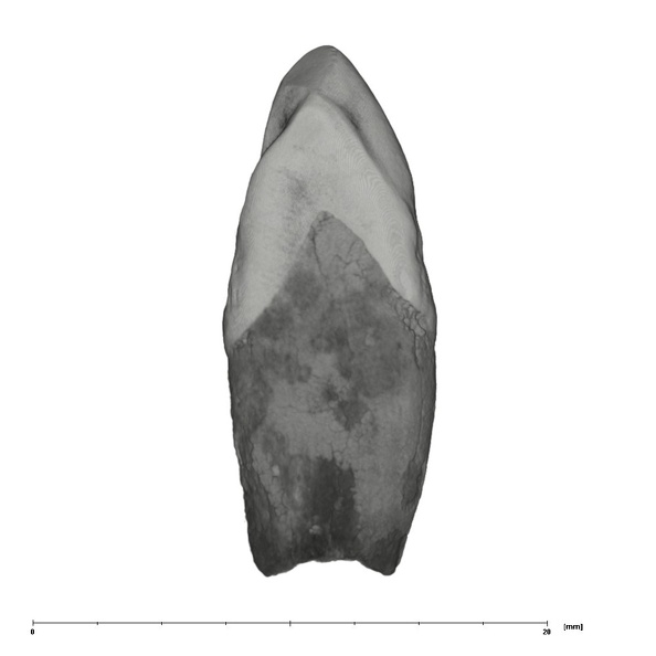 UW101-816 Homo naledi URC mesial