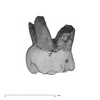 UW101-823 Homo naledi URDM1 lingual