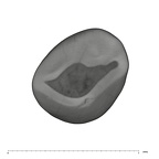UW101-824 Homo naledi LLDC occlusal