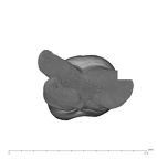 UW101-867 Homo naledi URM2 apical