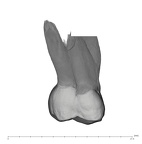 UW101-867 Homo naledi URM2 buccal